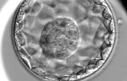 Le transfert d’embryons au stade de blastocyste améliore les taux de grossesse et d’enfants nés dans les traitements avec don d’ovocytes