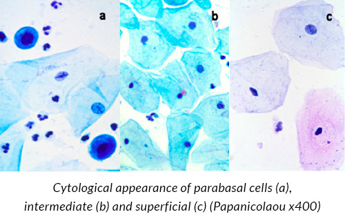 Cytological appearance cells (Papanicolaou)