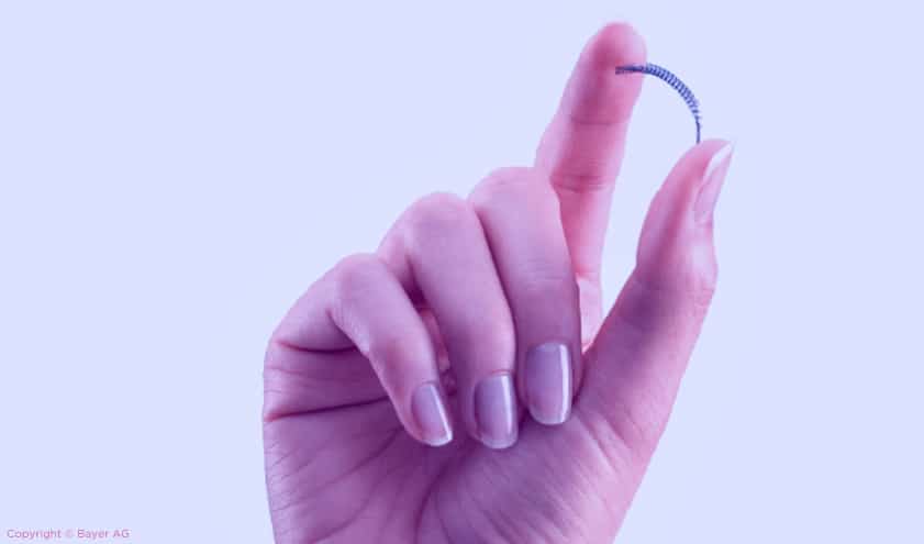 ¿Por qué se ha retirado el Essure?