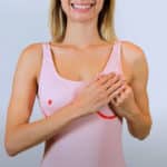6 patologías benignas de mama que no debes confundir con cáncer