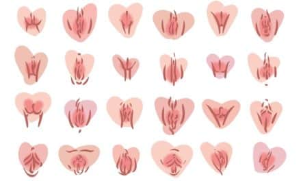 Mi vulva, ¿es normal?