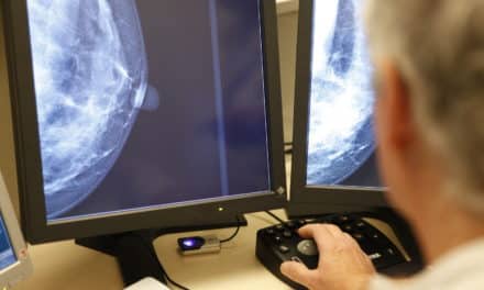 Mames denses: més risc de càncer?