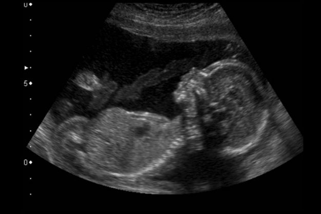 Controles del segundo trimestre