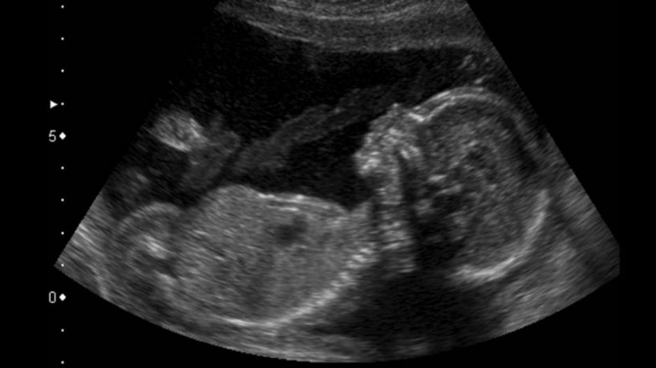 Controles del segundo trimestre