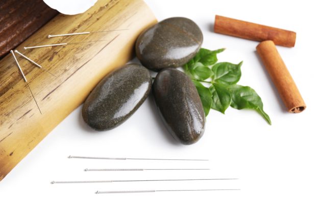 Acupuntura y menopausia