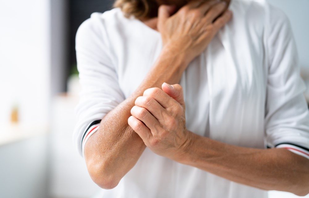 menopausia picores en la piel