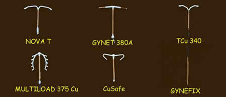 Diversos modelos de DIU