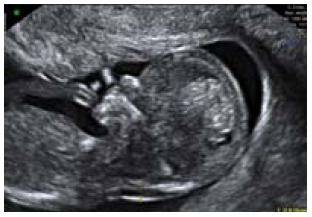 Diagnóstico prenatal y medicina fetal | Dexeus Mujer