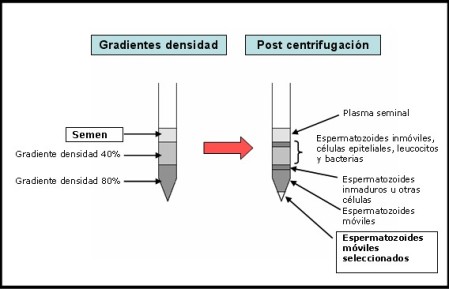 Gradientes densidad - Post centrifugacion