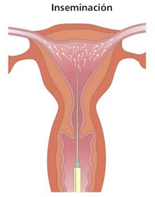 Inseminación