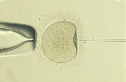 Visión de Microinyección espermática (ICSI)