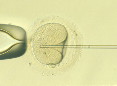 Visión de Microinyección espermática (ICSI)