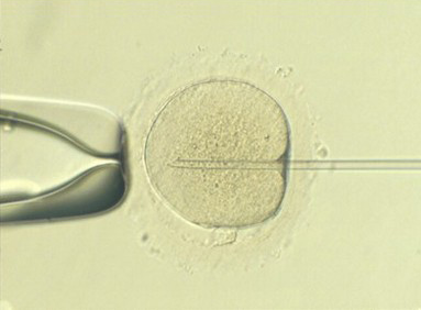 Visión de Microinyección espermática (ICSI)