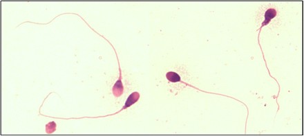 Morfología espermática