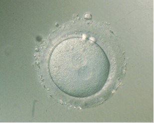 Ovocito fecundado (cigoto) en estadio de 2PN+2cp