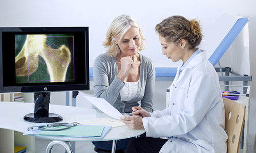 Menopausia - Prevención de la osteoporosis