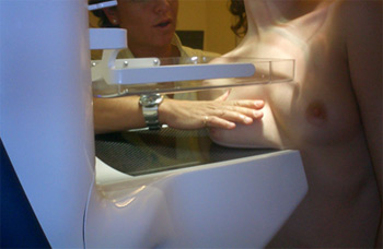 Realización de una mamografía