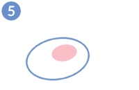 Ovodonación - Extracción de los óvulos de la donante