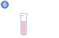 Ovodonación - Procesamiento de la muestra de semen