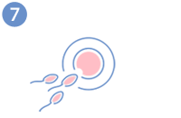 Ovodonación - Fecundación del óvulo y cultivo de los embriones
