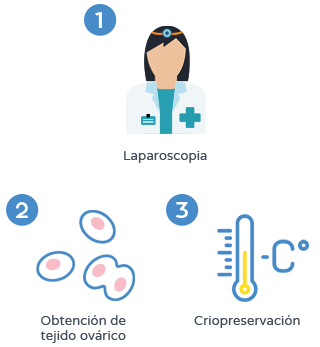 Preservación de la fertilidad - Criopreservación del tejido ovárico