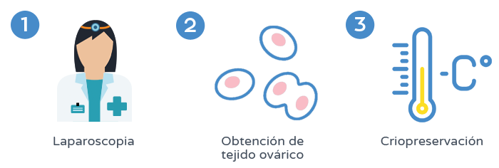 Preservación de la fertilidad - Criopreservación del tejido ovárico