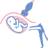 Diagnóstico prenatal - Biopsia corial