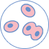 Cáncer ginecológico - Citología